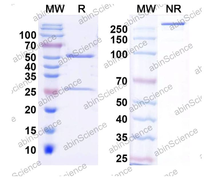 Abinscience InVivoMAb Anti-Human SAA Antibody (Iv0186) (HY110020-50ug)