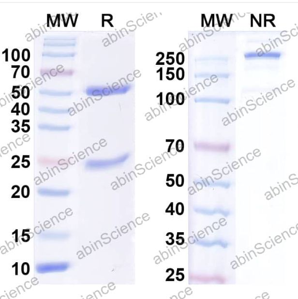 Abinscience InVivoMAb Anti-Human SAA1 Antibody (2A4) (HY110010-50ug)