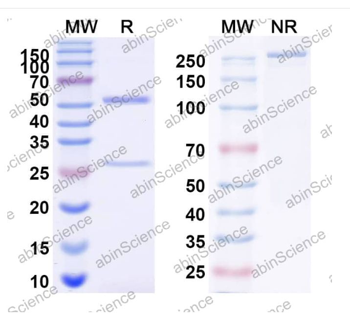 Abinscience InVivoMAb Anti-Nipah virus/NiV Prefusion Antibody (4H3) (VK521010-50ug)