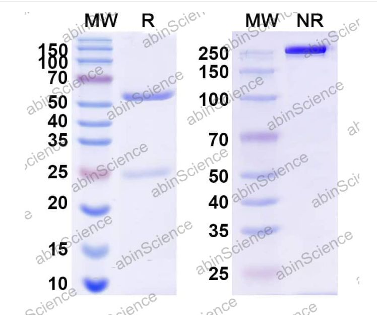 Abinscience InVivoMAb Anti-Nipah virus/NiV Prefusion Antibody (1A9) (VK521030-50ug)