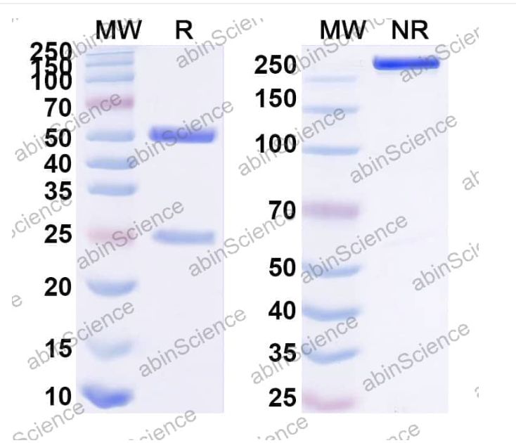 Abinscience InVivoMAb Anti-HIV-2 gp125 Antibody (7C8) (VK479010-1mg)
