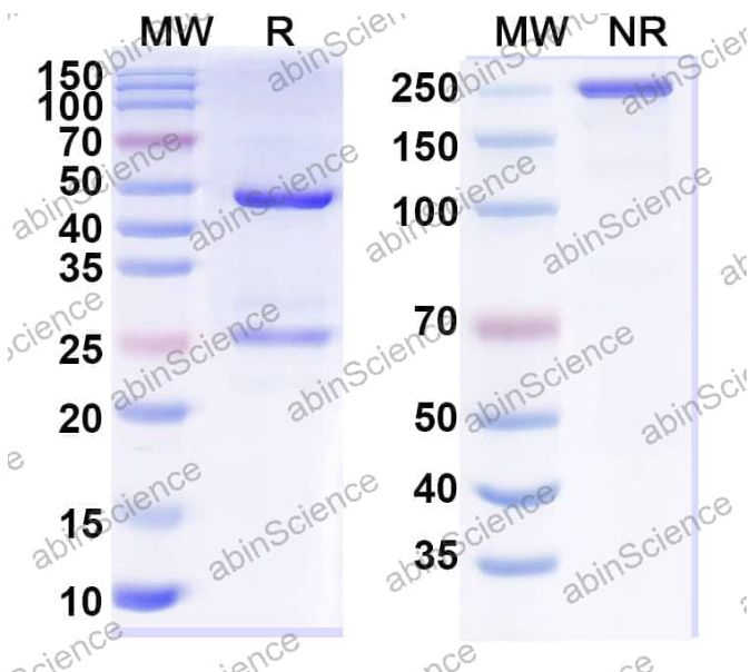 Abinscience InVivoMAb Anti-Human SOD1/Cu-Zn SOD Antibody (AP-101) (HF876010-100ug)