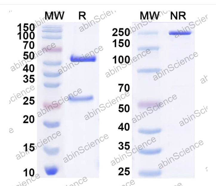 Abinscience InVivoMAb Anti-Plasmodium vivax RBP2b Antibody (4F7) (JN062010-50ug)