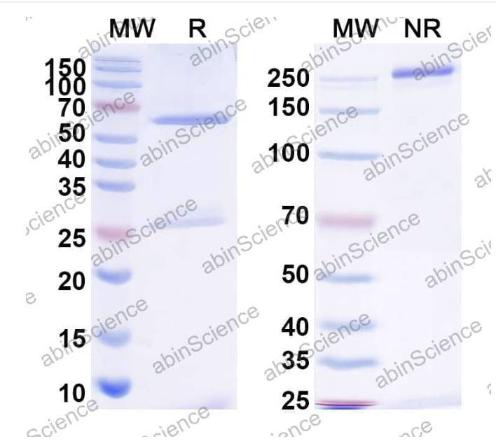 Abinscience InVivoMAb Anti-Influenza B virus(strain B/Maryland/1959) HA/Hemagglutinin Antibody (Iv0147) (VK515020-1mg)