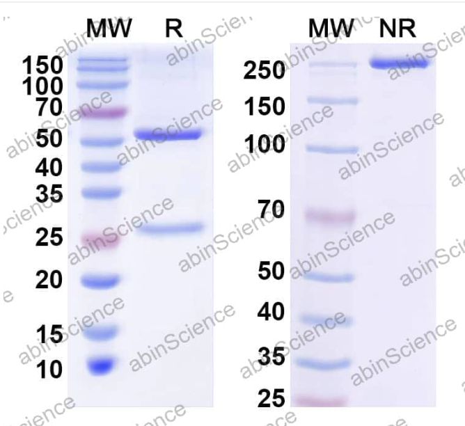 Abinscience InVivoMAb Anti-Bordetella pertussis cyaA/Cyclolysin Antibody (Iv0144) (JN987010-50ug)