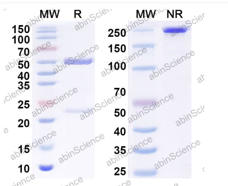 Abinscience InVivoMAb Anti-Human 5'-Nucleotidase/CD73 Antibody (TB19) (HB209010-50ug)