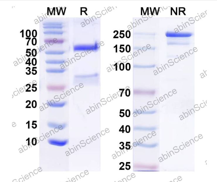 Abinscience InVivoMAb Anti-Human DPEP3 Antibody (Iv0162) (HV426010-1mg)