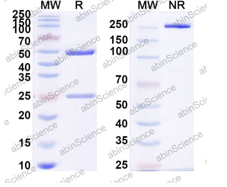 Abinscience InVivoMAb Anti-Candida albicans HSP90 Antibody (Iv0155) (JN043010-50ug)