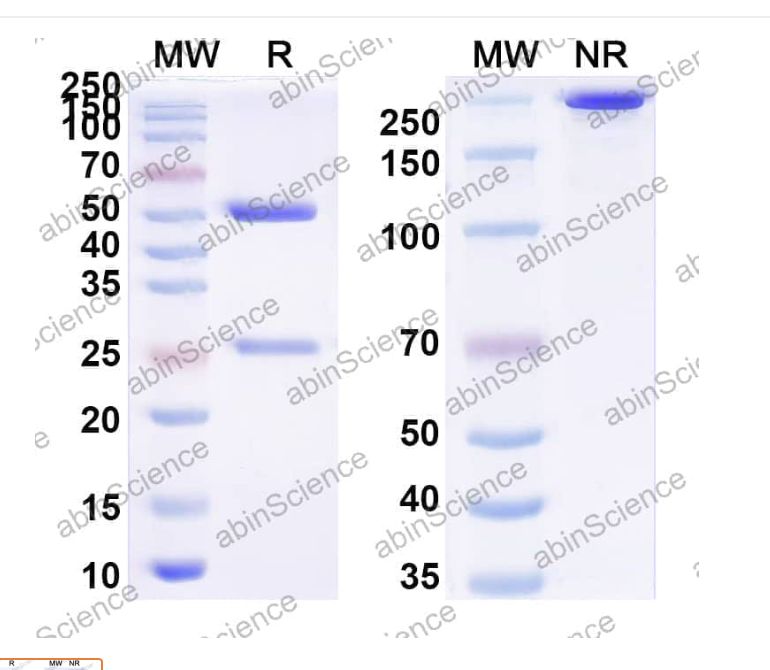 Abinscience InVivoMAb Anti-CVB1 Mature virion in complex Antibody (Iv0143) (VK774030-1mg)