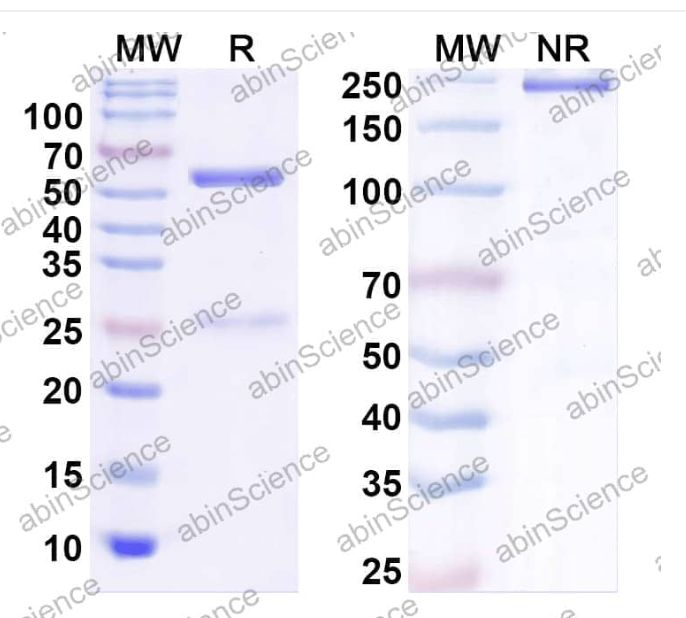 Abinscience InVivoMAb Anti-Human Pentraxin 2/SAP Antibody (Iv0161) (HY058010-1mg)
