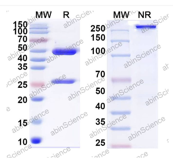 Abinscience InVivoMAb Anti-MACV GP1 glycoprotein Antibody (MAC1) (VK765010-100ug)