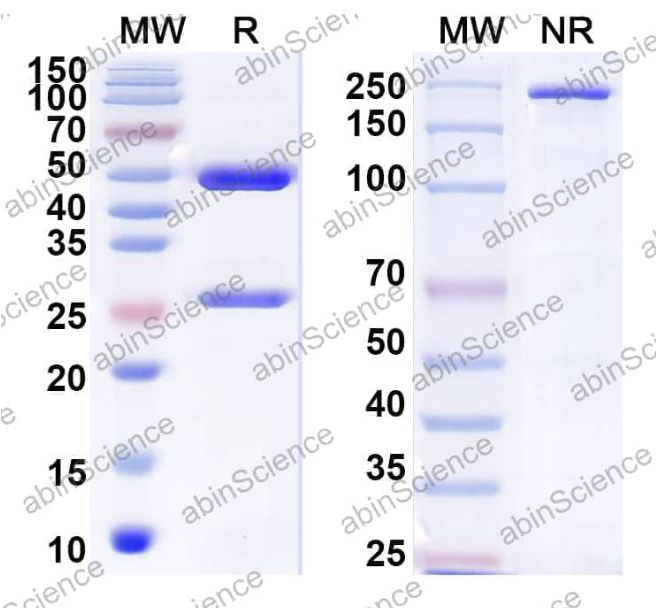 Abinscience InVivoMAb Anti-JUNV GP1 glycoprotein Antibody (JUN1#) (VK721010-100ug)