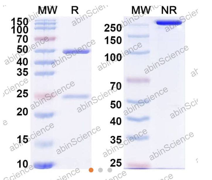 Abinscience InVivoMAb Anti-Human PRL-3/PTP4A3 Antibody (Iv0170) (HF618010-100ug)