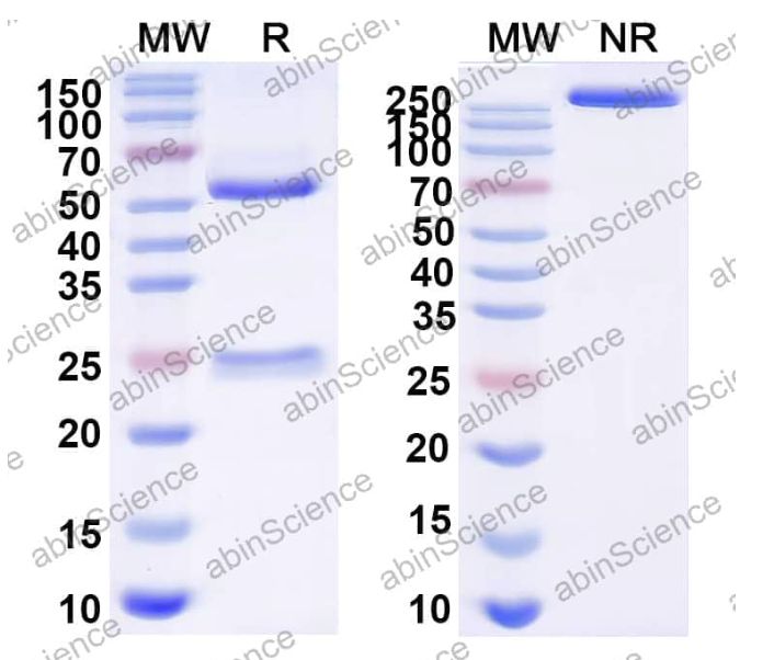 Abinscience InVivoMAb Anti-HBV-A S-HBsAg/SHB Antibody (Iv0151) (VK619010-100ug)
