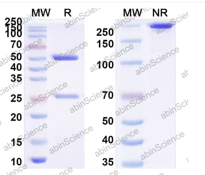Abinscience InVivoMAb Anti-CVB1 Mature virion in complex Antibody (Iv0142) (VK774020-50ug)