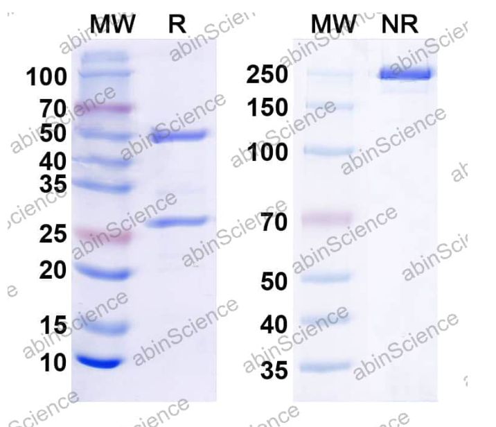 Abinscience InVivoMAb Anti-Human ENT2 Antibody (Iv0157) (HY377010-50ug)