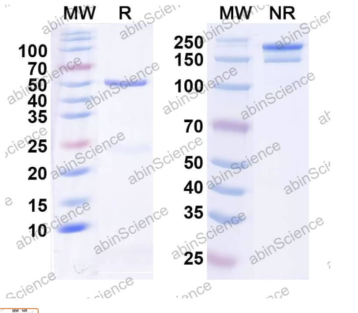 Abinscience InVivoMAb Anti-Human Angiopoietin-like Protein 3/ANGPTL3 Antibody (Iv0160) (HV176010-50ug)