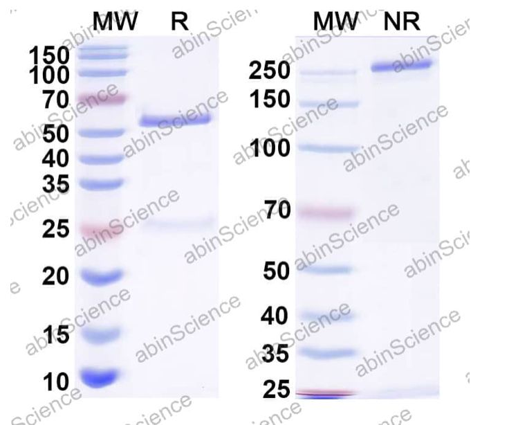 Abinscience InVivoMAb Anti-HBV-A S/L-HBsAg/L glycoprotein Antibody (Iv0152) (VK539010-1mg)
