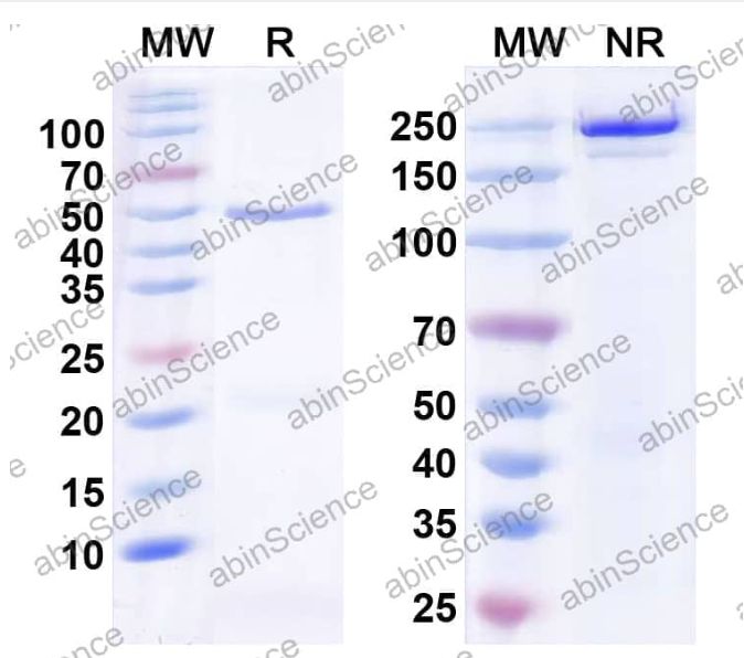 Abinscience InVivoMAb Anti-Human PSMA/FOLH1/NAALADase I Antibody (Iv0137) (HC669010-100ug)