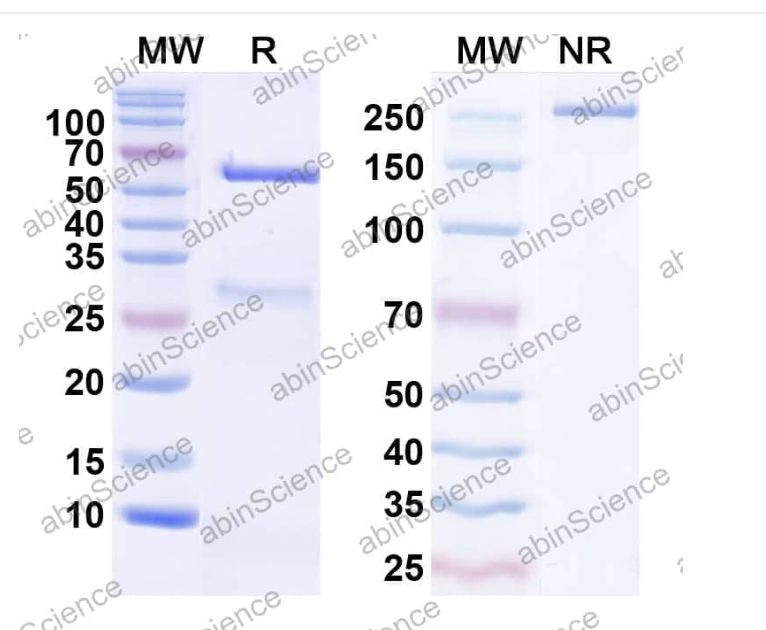 Abinscience InVivoMAb Anti-Human CA9 Antibody (Iv0098) (HS840010-100ug)
