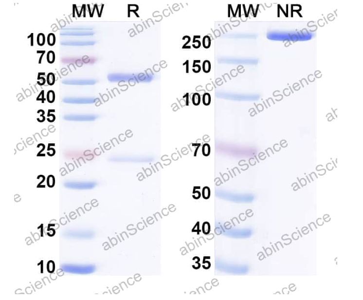 Abinscience InVivoMAb Anti-CVA16 mature virion in complex Antibody (Iv0109) (VK525020-50ug)