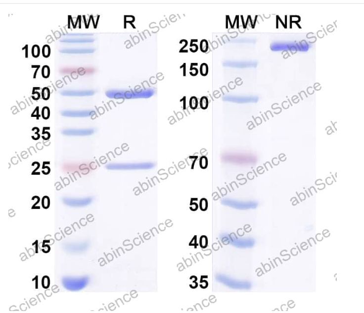 Abinscience InVivoMAb Anti-Human Oncostatin M/OSM Antibody (Iv0092) (HB745010-50ug)