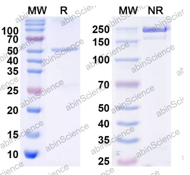 Abinscience InVivoMAb Anti-Human A33 Antibody (Iv0095) (HV981010-50ug)