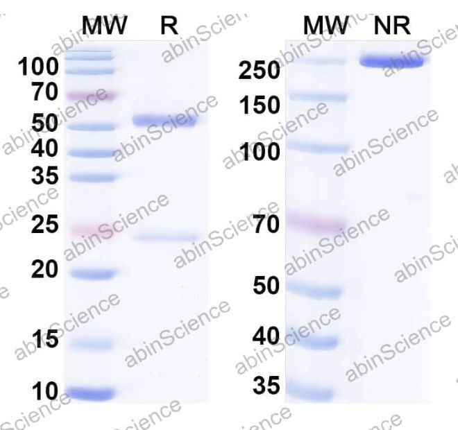Abinscience InVivoMAb Anti-CVB1 mature virion in complex Antibody (Iv0110) (VK774010-1mg)