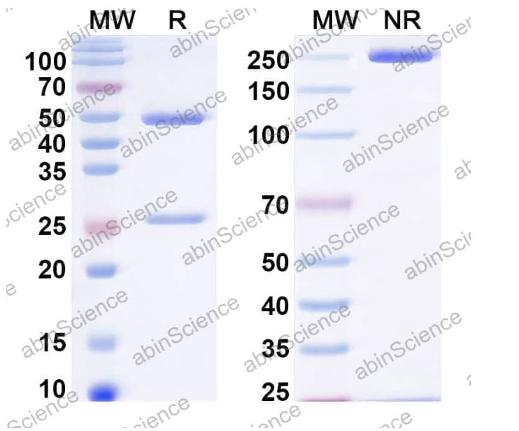 Abinscience InVivoMAb Anti-HIV-1 env/Env polyprotein Antibody (Iv0115) (VK617060-1mg)