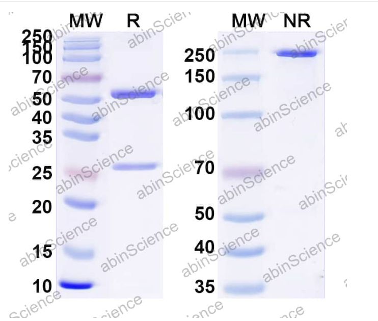 Abinscience InVivoMAb Anti-Brazilian scorpion Tityustoxin VII/Toxin VII/Ts7 Antibody (Iv0135) (ZP769010-1mg)