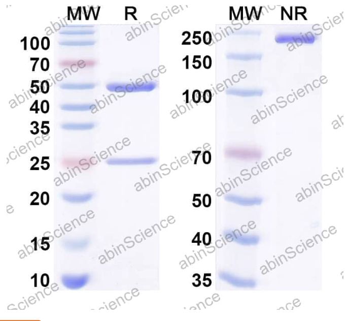 Abinscience InVivoMAb Anti-Human BDNF Antibody (Iv0093) (HB935010-100ug)