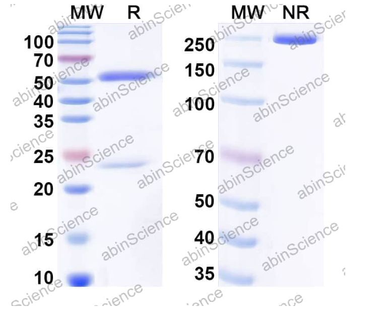 Abinscience InVivoMAb Anti-CVA16 mature virion in complex Antibody (Iv0108) (VK525010-50ug)