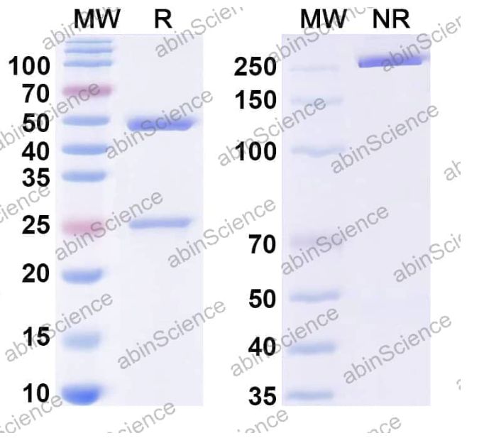 Abinscience InVivoMAb Anti-HPV B19/B19V VP1/Coat protein VP1 Antibody (Iv0008) (VK449010-1mg)