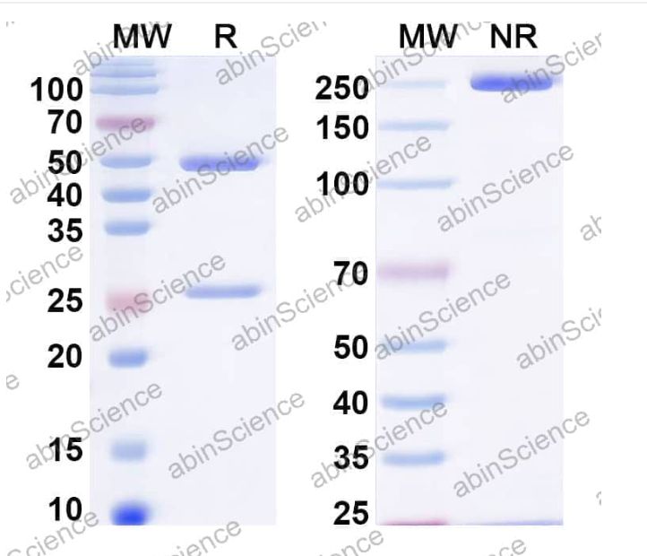Abinscience InVivoMAb Anti-HIV-1 env/Env polyprotein Antibody (Iv0116) (VK617070-50ug)