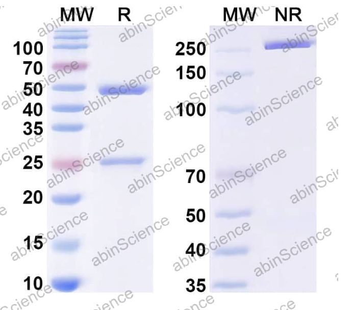 Abinscience InVivoMAb Anti-HPV B19/B19V VP1/Coat protein VP1 Antibody (Iv0009) (VK449020-50ug)