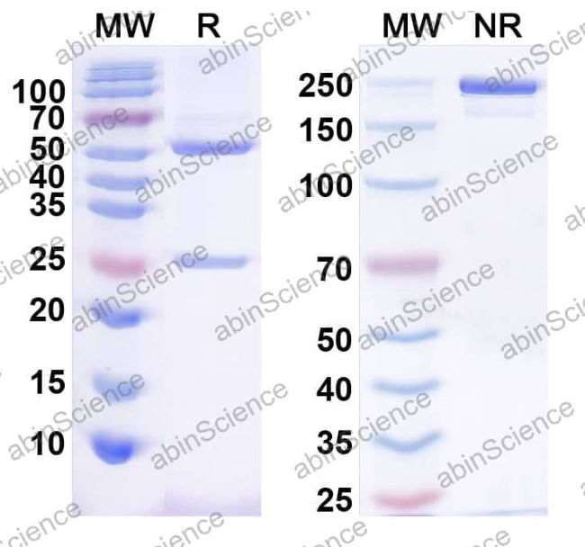 Abinscience InVivoMAb Anti-Human IL-5 Antibody (Iv0021) (HY218010-100ug)