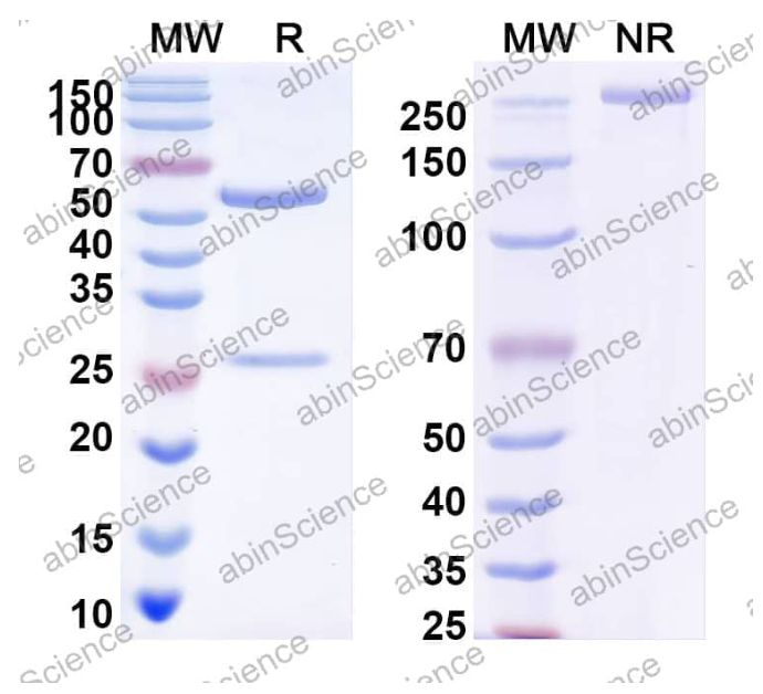 Abinscience InVivoMAb Anti-VZV/HHV-3 gH/gL Complexes Antibody (Iv0042) (VK724020-1mg)