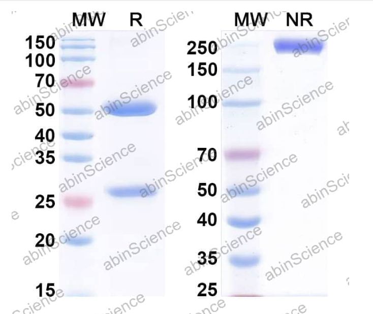 Abinscience InVivoMAb Anti-Human PDGF-D Antibody (Iv0074) (HV296010-100ug)
