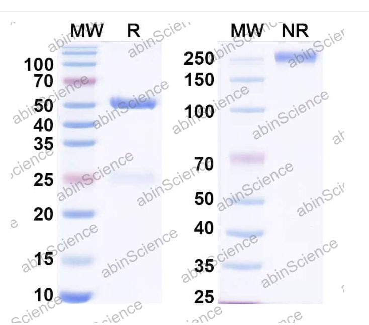 Abinscience InVivoMAb Anti-Human CCL17/TARC Antibody (Iv0083) (HV615010-100ug)