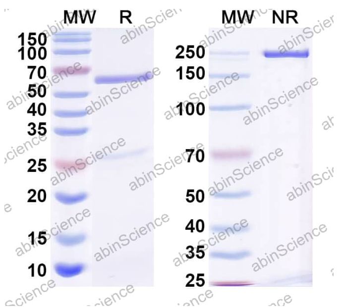 Abinscience InVivoMAb Anti-HIV-1 env/Env polyprotein Antibody (Iv0039) (VK617010-1mg)