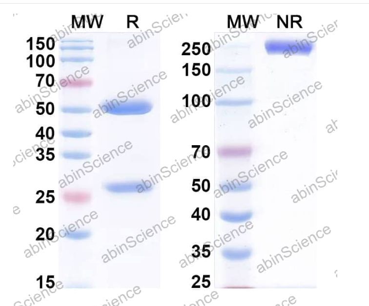 Abinscience InVivoMAb Anti-Human PDGF-C Antibody (Iv0073) (HV705010-50ug)