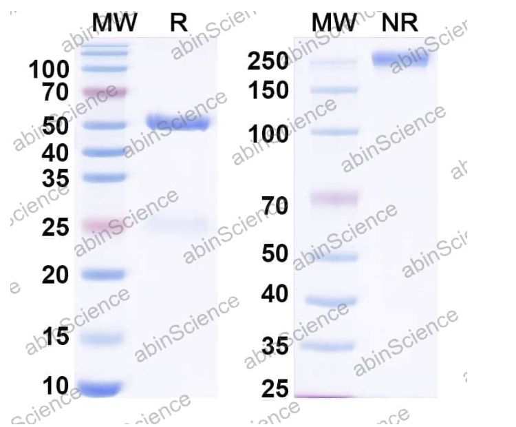 Abinscience InVivoMAb Anti-Human CCL8/MCP-2 Antibody (Iv0080) (HX249010-50ug)