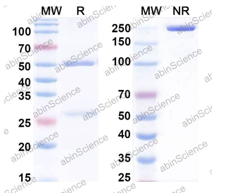 Abinscience InVivoMAb Anti-Human GDF-11/BMP-11 Antibody (Iv0062) (HF869010-50ug)