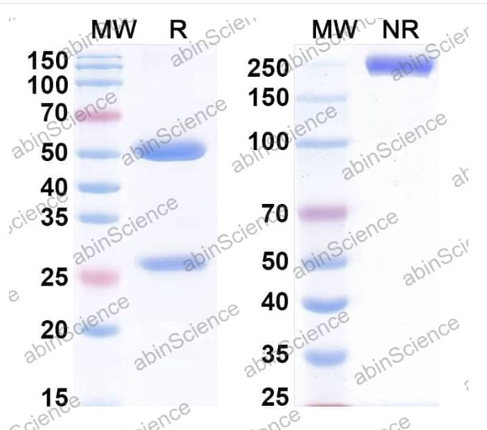 Abinscience InVivoMAb Anti-Human PDGF-B Antibody (Iv0072) (HF877010-100ug)