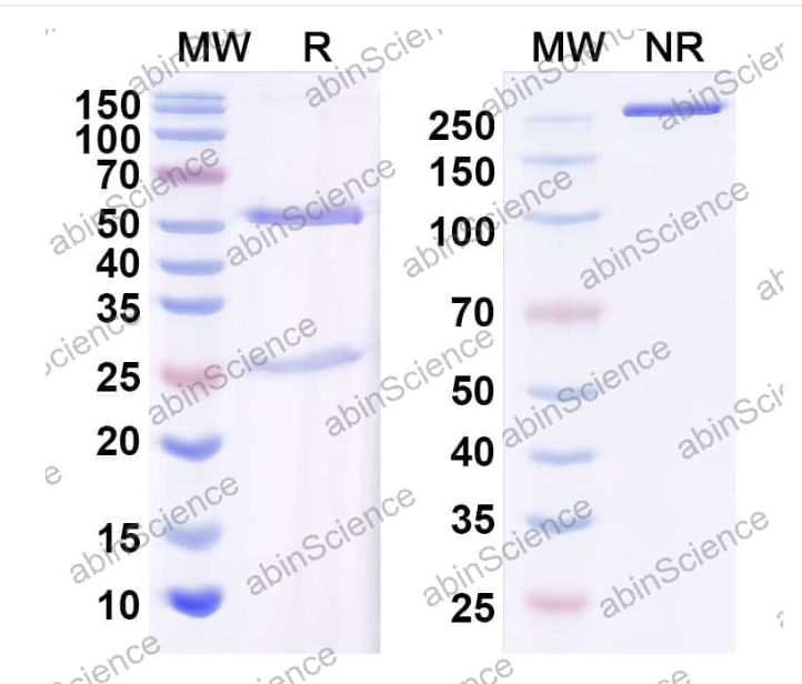 Abinscience InVivoMAb Anti-HIV-1 gp120/Glycoprotein 120 Antibody (Iv0038) (VK617020-50ug)