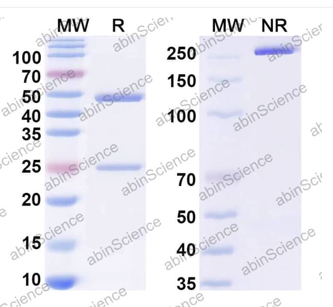 Abinscience InVivoMAb Anti-HPV B19/B19V NS1/Non-structural protein 1 Antibody (Iv0007) (VK472010-50ug)