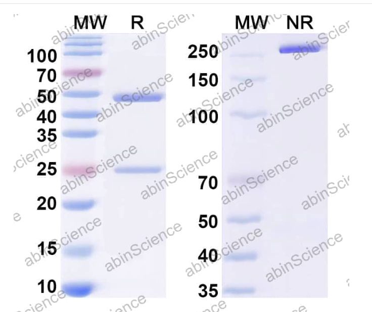 Abinscience InVivoMAb Anti-HPV58 L1/Major capsid protein L1 Antibody (Iv0004) (VK760030-100ug)