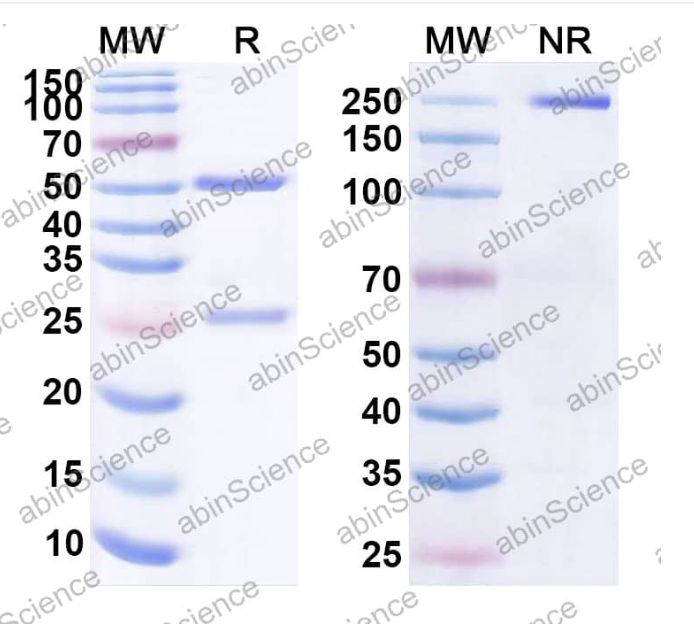 Anti-Human Heparanase Neutralizing Recombinant Antibody (A54) (HC115013-100ug)