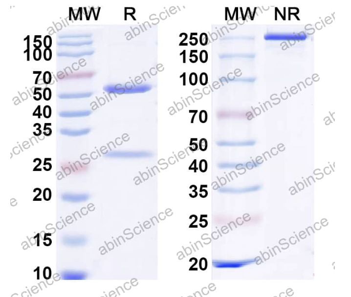 Abinscience InVivoMAb Anti-Mouse IL-11 Antibody (Iv0284) (MB978010-50ug)