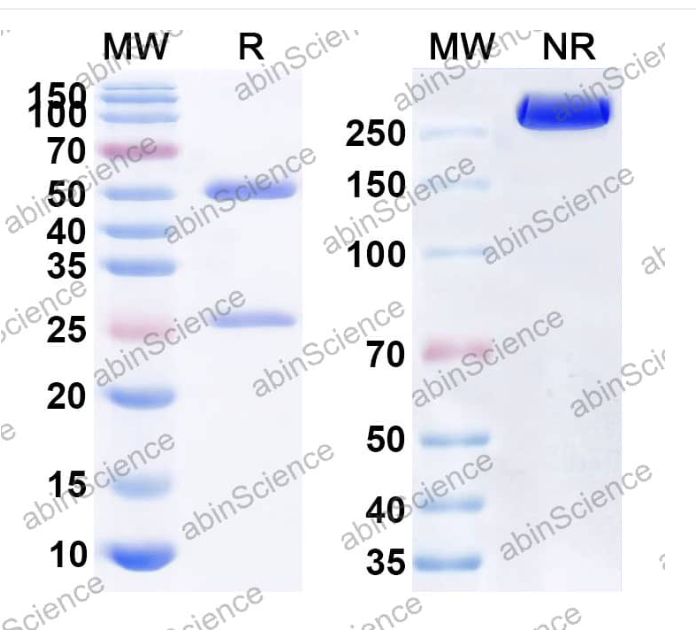 Abinscience InVivoMAb Anti-Mouse IL-11 R alpha Antibody (X209) (MC604010-1mg)